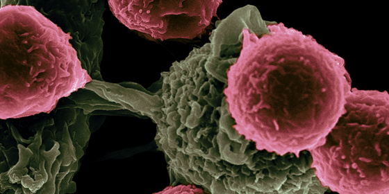 Regular Cancer Screening Leads To Early Detection: Key To Cancer Survival